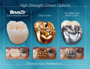 high-strength-crown-options_lores